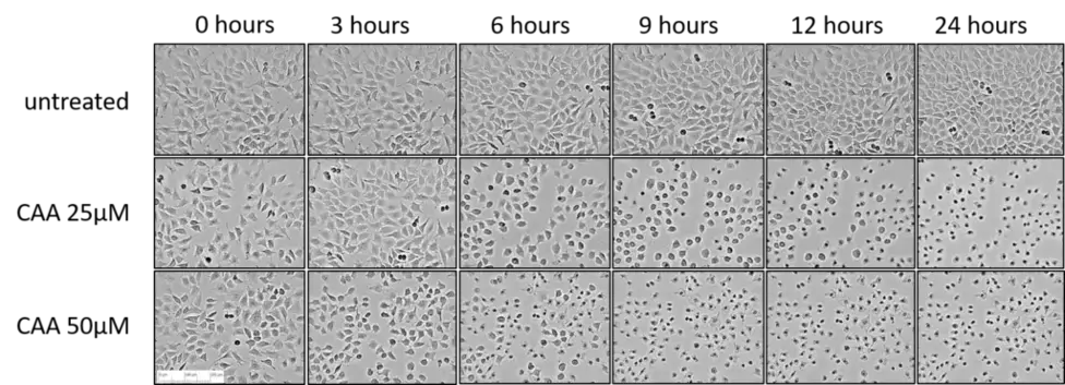 CAA-Effekte auf die Zellmorphologie
